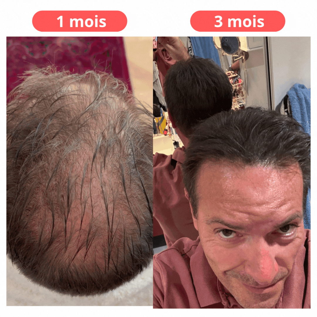 Micro-Infusione Capillare Rigenerante Uomo
